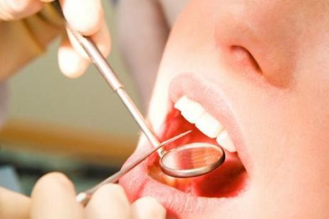 Saúde bucal no paciente transplantado de medula óssea